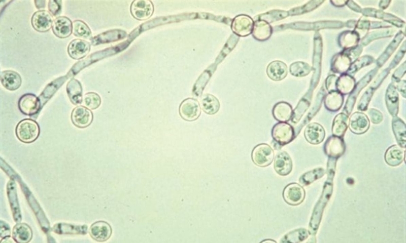 Soi tươi KOH nhằm mục đích gì? Khi nào cần soi tươi KOH 2
