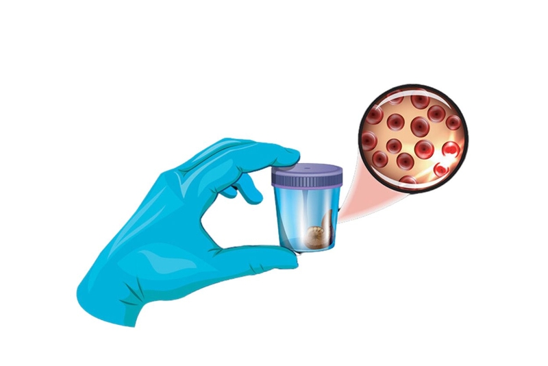 Tìm hiểu chi tiết về xét nghiệm soi tươi phân phát hiện ký sinh trùng 2