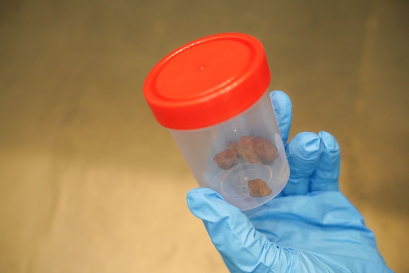 Tìm hiểu chi tiết về xét nghiệm soi tươi phân phát hiện ký sinh trùng 3