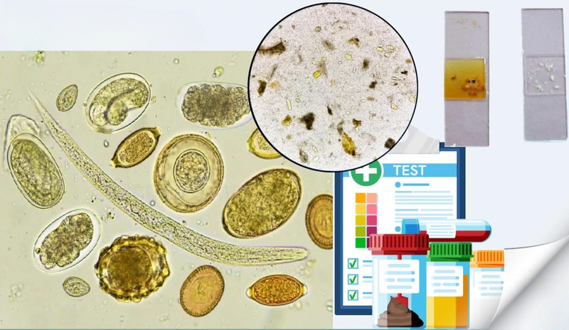 Tìm hiểu chi tiết về xét nghiệm soi tươi phân phát hiện ký sinh trùng 4
