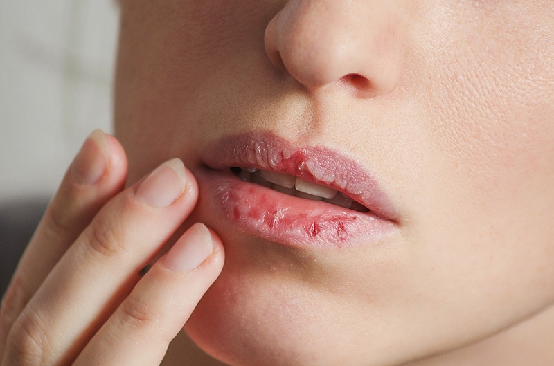 Mối nguy hại khôn lường từ son kém chất lượng 2