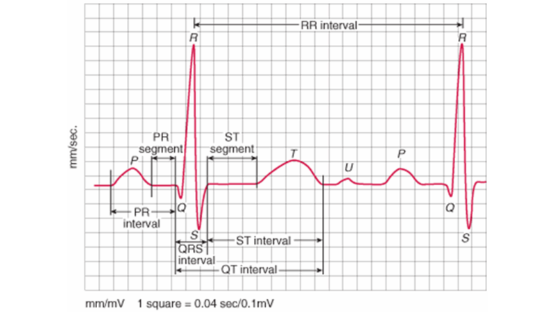 Sóng P là gì? Các dạng sóng P trong điện tâm đồ2