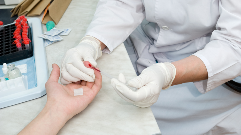 Sốt phát ban ở người lớn và những thông tin liên quan 5