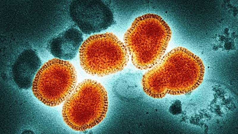 Sốt siêu vi có lây không? Các con đường lây truyền chính của sốt siêu vi 1