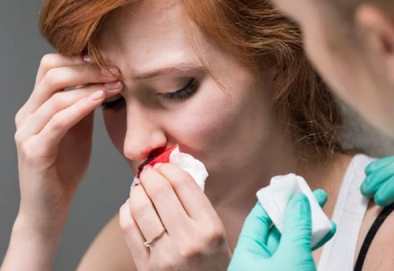 Sốt xuất huyết chảy máu cam nguy hiểm như thế nào – bạn đã biết chưa?1