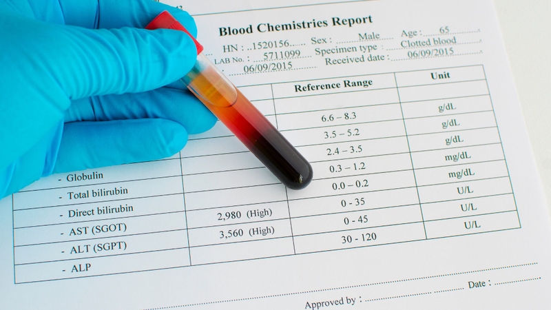 Sốt xuất huyết máu đông: Cảnh báo nguy hiểm từ biến chứng rối loạn đông máu 3