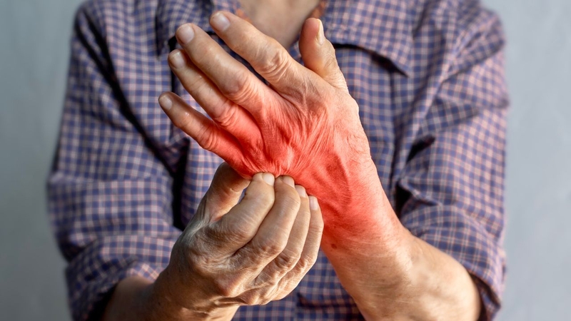 Sốt xuất huyết ngứa lòng bàn tay bàn chân 2