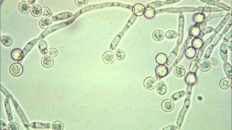 Spobet 100mg – Thuốc điều trị hiệu quả những bệnh lý về nấm ký sinh trên cơ thể&nbsp;1