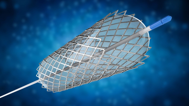 Stent là gì​? Một số loại stent được sử dụng phổ biến trong điều trị hiện nay 3