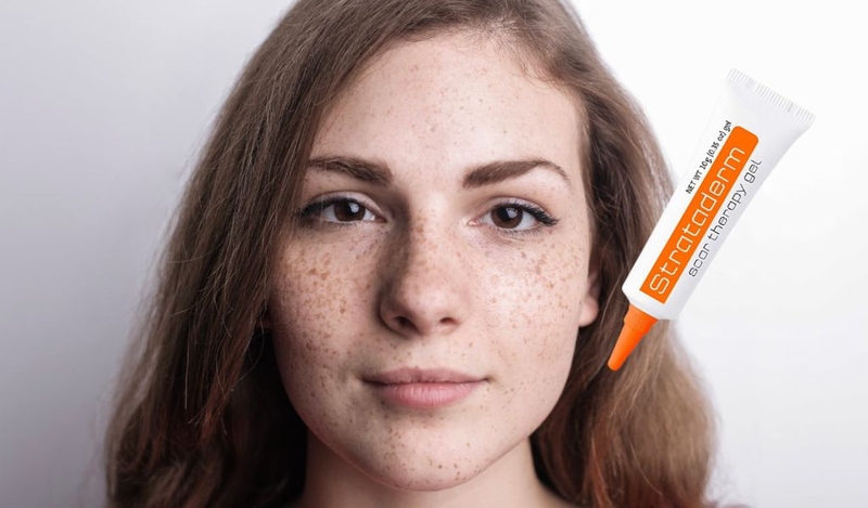 Strataderm có trị nám tàn nhang không? Hiệu quả như thế nào? 2