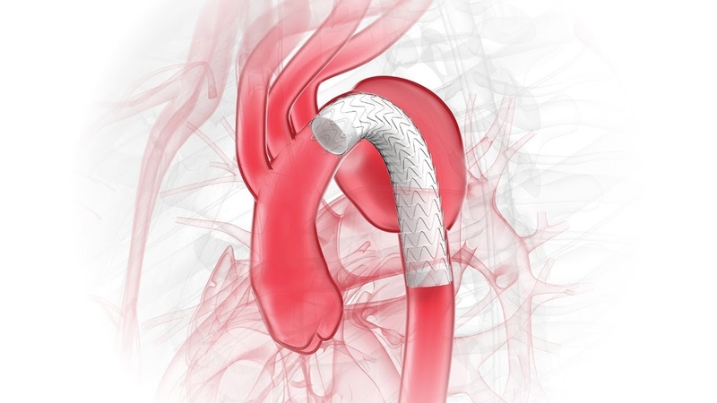 Styrene là gì? Styrene được ứng dụng như thế nào và độc tính của nó? 3