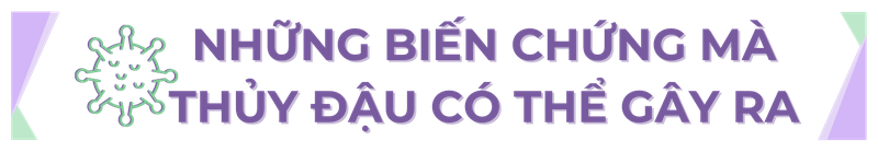 Sự cần thiết của việc tiêm phòng thủy đậu - Các bằng chứng khoa học về tính hiệu quả và an toàn của vắc xin h2 2