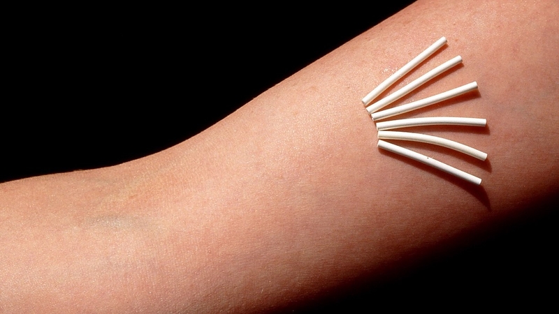 Sử dụng cấy que tránh thai có bị nám da không? 1