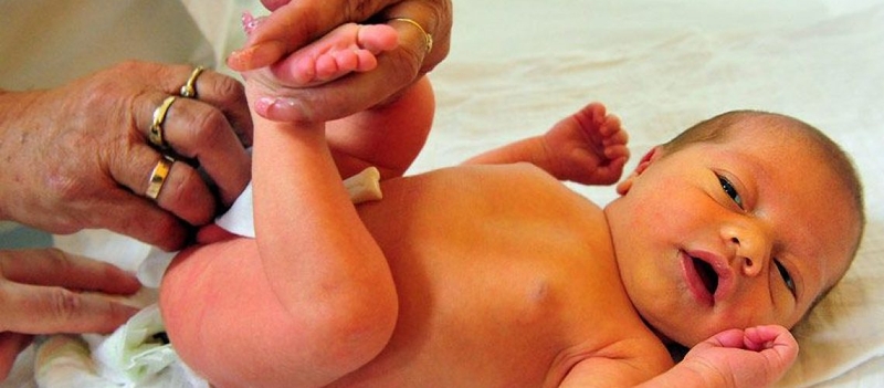 Tình trạng vàng da ở trẻ sơ sinh