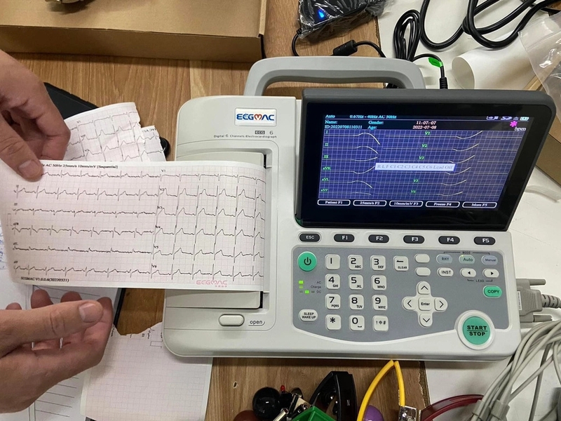 Sự khác biệt giữa cuồng nhĩ và rung nhĩ không phải ai cũng biết 1