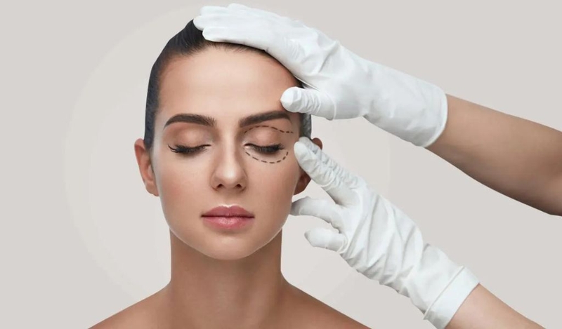 Sự khác biệt giữa nhấn mí và cắt mí? Nên nhấn mí hay cắt mí? 2