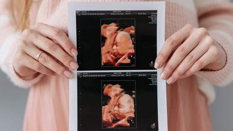 Sự khác nhau giữa mang thai con trai và con gái: Dấu hiệu nào dễ nhận biết? 1