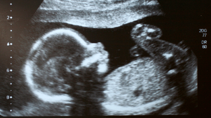 Sự khác nhau giữa mang thai con trai và con gái: Dấu hiệu nào dễ nhận biết? 5