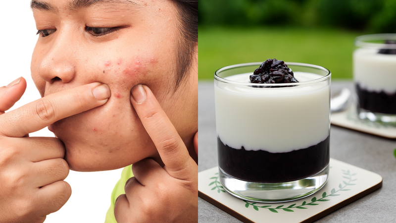 Người bị mụn có thể ăn sữa chua nếp cẩm với lượng vừa phải