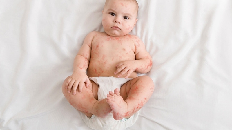 Sữa hạt cho bé dị ứng đạm bò: Giải pháp dinh dưỡng an toàn cho con yêu 1