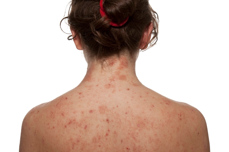 Sữa tắm Tây Thi có tốt không? 1