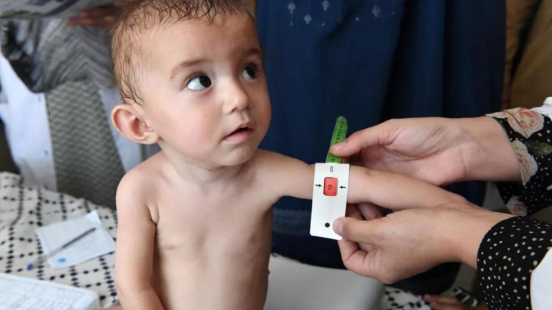 Sữa tăng cân cho bé 3 tuổi: Giải pháp phát triển toàn diện cho trẻ 3