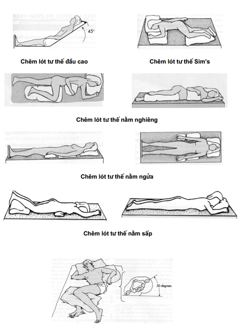 Sức khỏe: Phòng ngừa loét tì đè2