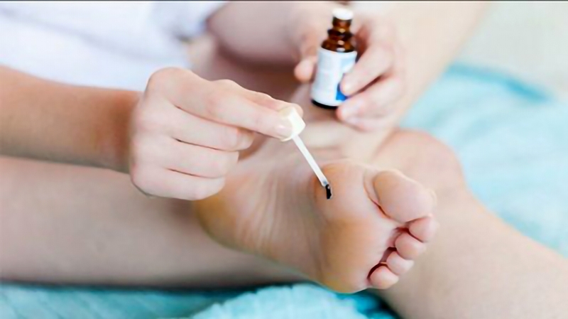 sui-mao-ga-o-chan-trieu-chung-nguyen-nhan-va-cach-dieu-tri 3.jpg