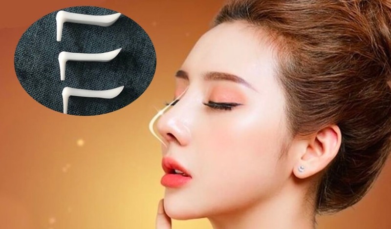 Sụn nâng mũi softxil là gì? Nâng mũi sụn Softxil có tốt và an toàn? 1