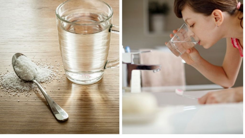 Sưng chân răng nên làm gì? 2