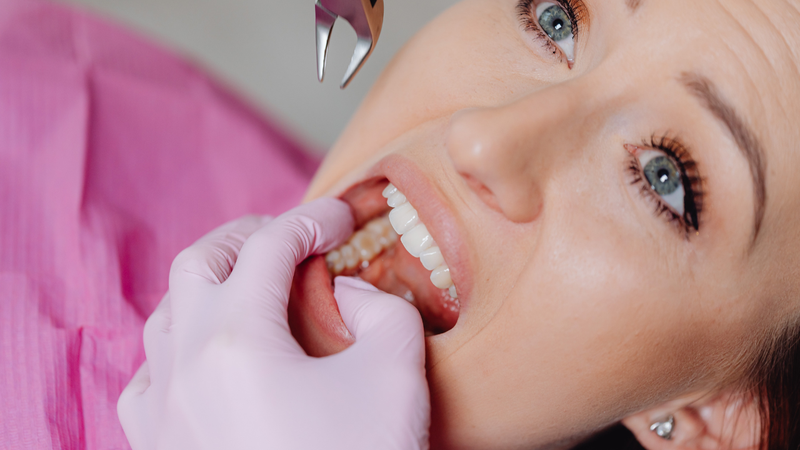 Sưng nướu răng khôn gây ảnh hưởng đến các răng kế cận