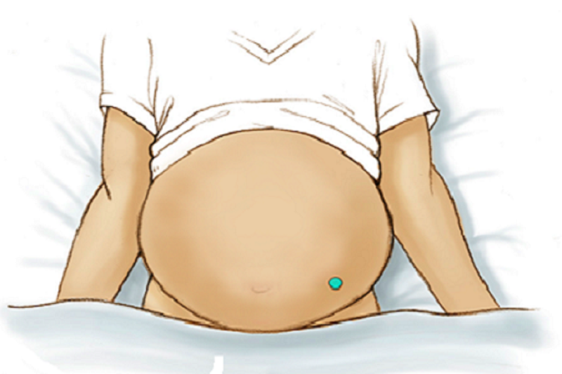 Suy dinh dưỡng gây xơ gan thì cần phải làm gì? 1