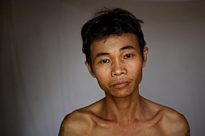 Những điều cần biết về suy dinh dưỡng ở người trưởng thành 1