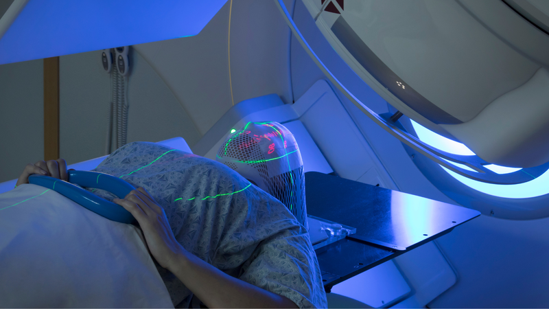 Suy giáp sau điều trị phóng xạ 1