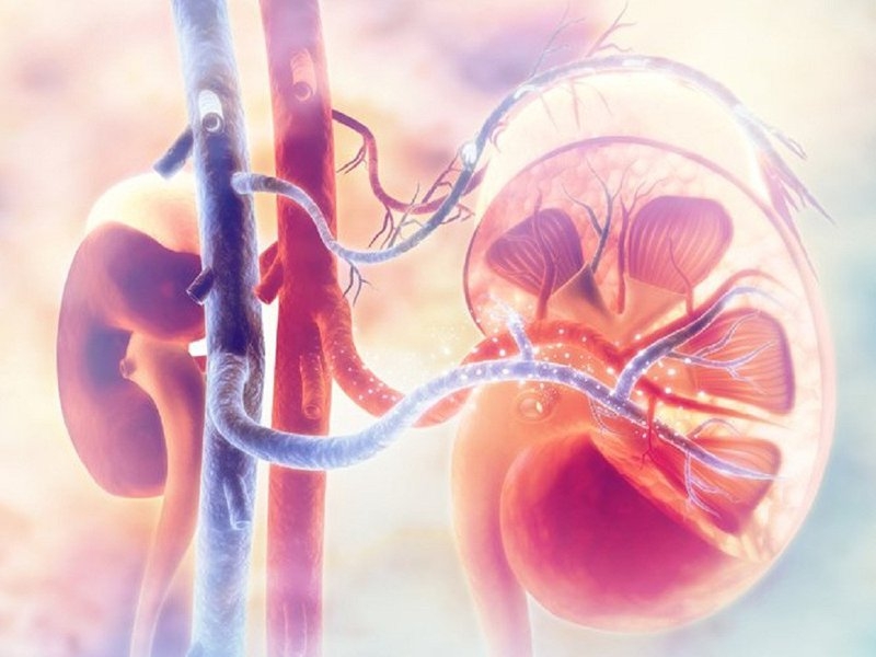 Suy thận cấp gây tụt canxi nghiêm trọng