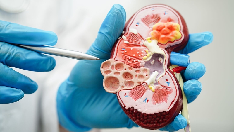 Suy thận có di truyền không? Cách phòng ngừa bệnh hiệu quả 1