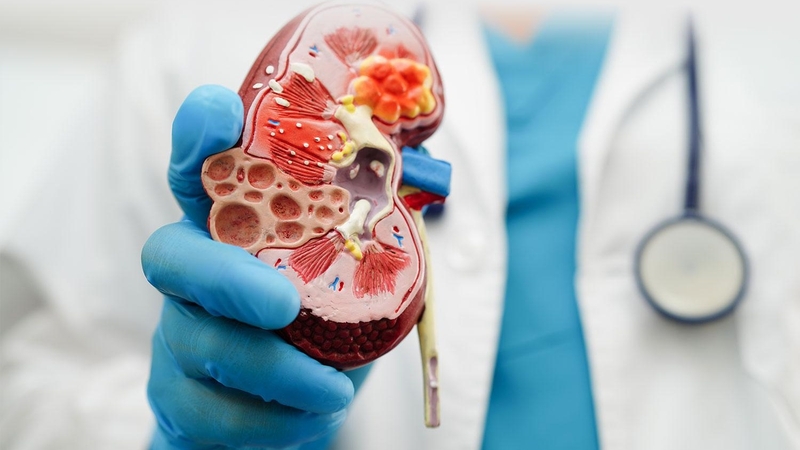 Suy thận giai đoạn cuối: Những việc nên làm để kéo dài tuổi thọ 1