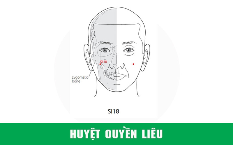 Huyệt Quyền Liêu là gì?
