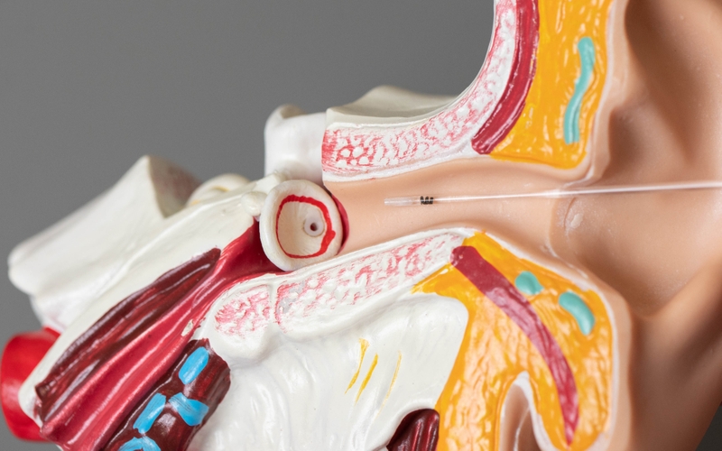 Tác dụng “bất ngờ” của phương pháp đặt ống thông khí màng nhĩ 1