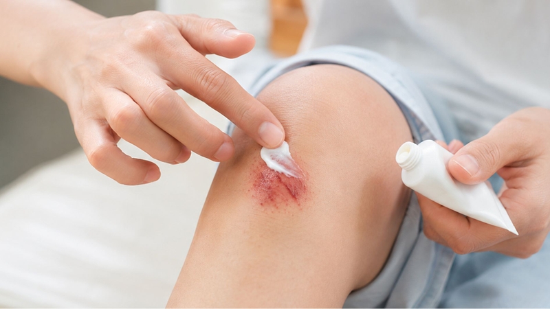 Các sản phẩm chứa nano bạc hỗ trợ giảm nguy cơ nhiễm khuẩn