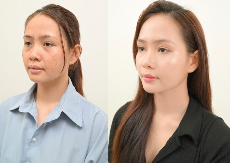 Tác dụng của uống bột sắn dây? Uống bột sắn dây sống có hại dạ dày không? 2