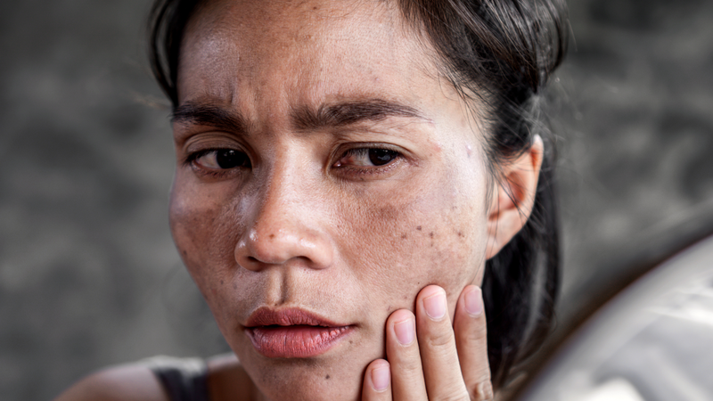 Tác dụng của vitamin C đối với làn da: Làm đẹp từ bên trong 2