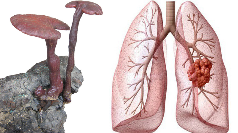 Nấm lim xanh chữa ung thư phổi