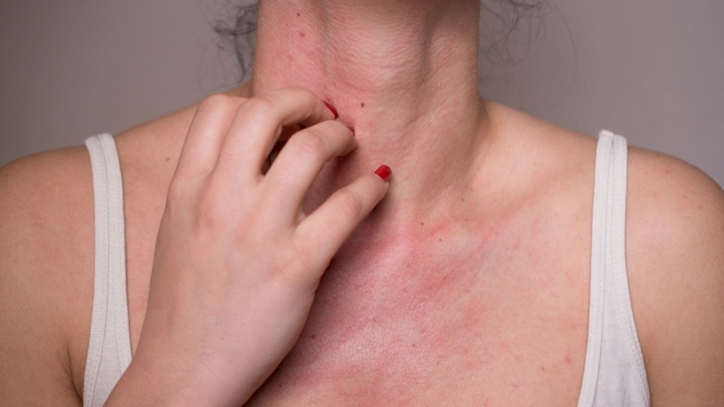 Tác dụng phụ của vắc xin: Những điều cần biết để an tâm tiêm chủng 2