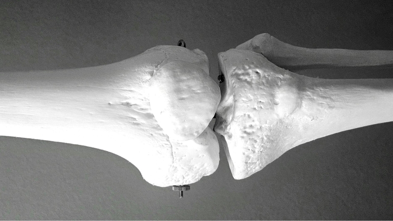 Thừa vitamin A có thể làm rối loạn chuyển hóa canxi, từ đó làm tăng nguy cơ loãng xương