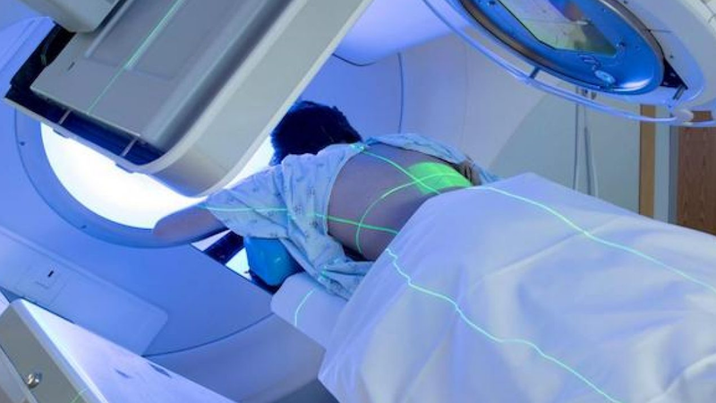 Xạ trị ở bệnh nhân ung thư