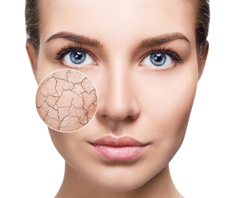 Tác hại của Baking Soda đối với da: gây viêm da, nhiễm trùng da