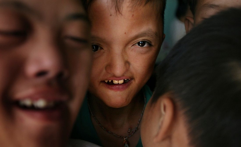 Tác hại của chất độc màu da cam: Nỗi đau kéo dài qua nhiều thế hệ 2