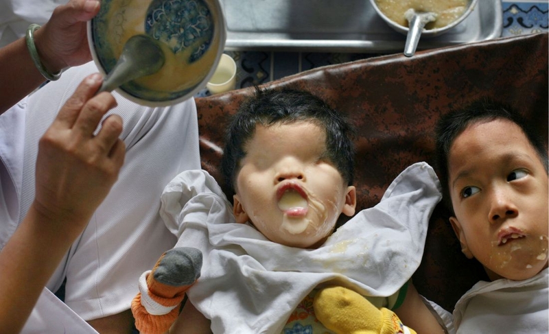 Tác hại của chất độc màu da cam: Nỗi đau kéo dài qua nhiều thế hệ 3