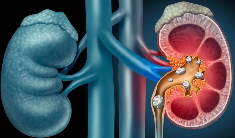 Tác hại của đậu bắp không phải ai cũng biết và những đối tượng nên tránh? 3